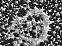 erythrocyte