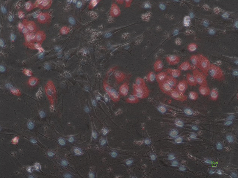 ESR12-F: Toxicity of nano-objects on human cells models