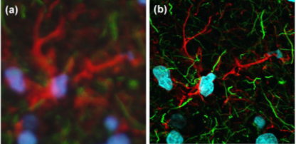 Confocal Vs Widefield